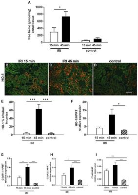 Labile Heme Aggravates Renal Inflammation and Complement Activation After Ischemia Reperfusion Injury